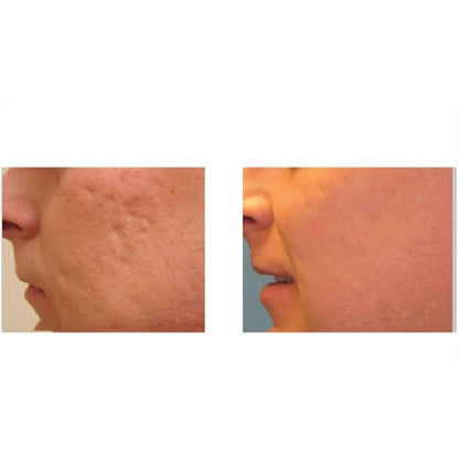 Elicina, Face Cream