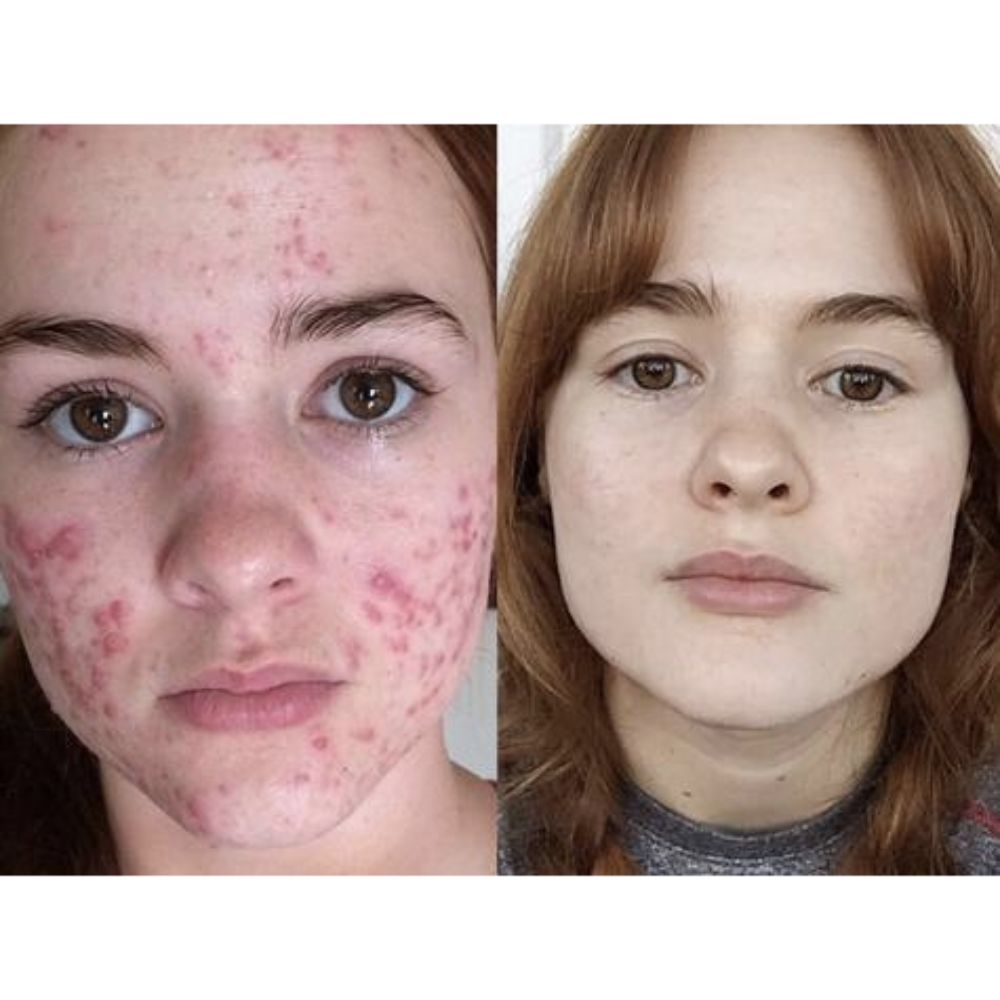 Elicina,ECO Face Cream