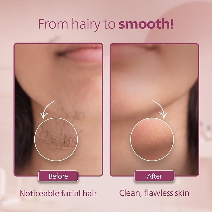 Philips, Cordless Facial Hair Remover with Wide Hypoallergenic Head for gentle experience at home
